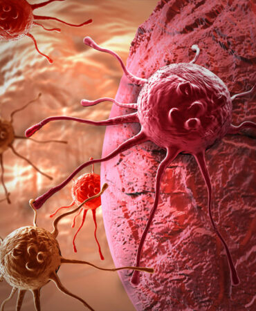 Kanser, meme kanseri, rahim kanseri, kolon kanseri